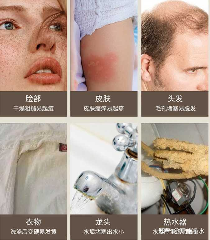 软化水设备使用_软化水设备工作流程_软化水要上哪些设备